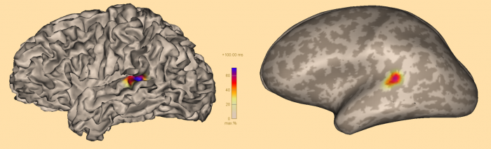 PDF) A test of brain electrical source analysis (BESA): A simulation study